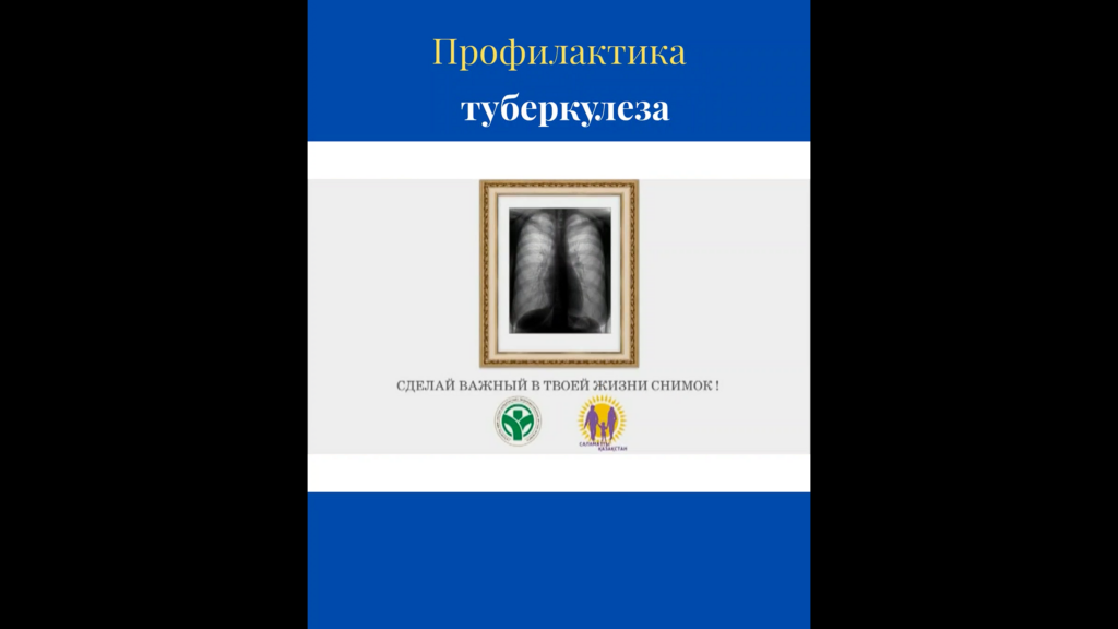 Туберкулёз остаётся серьёзным заболеванием, но его можно предупредить